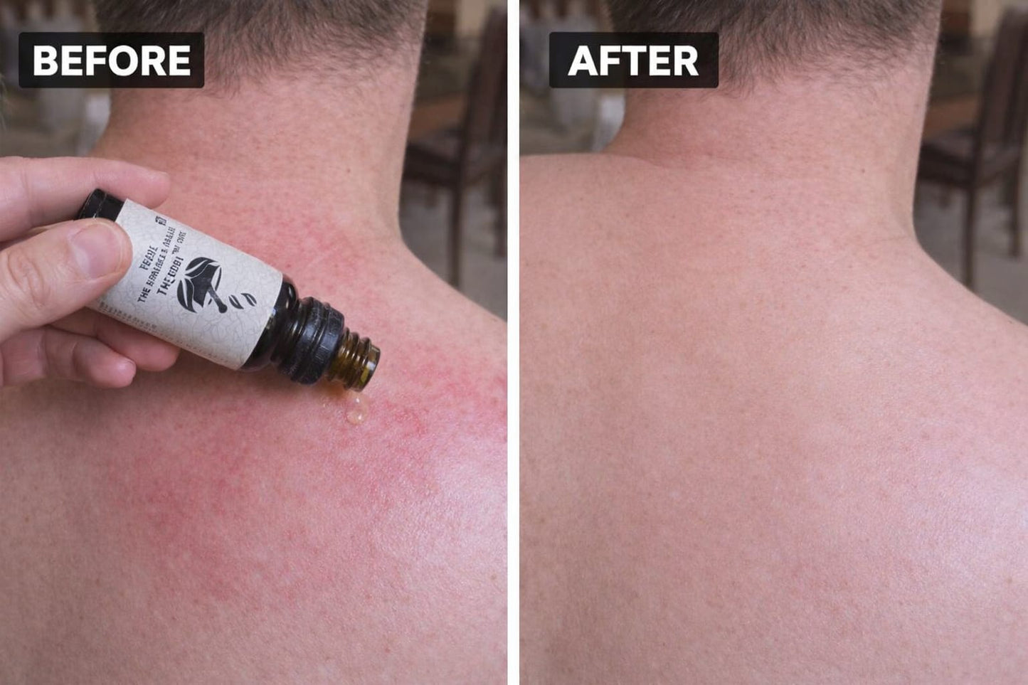 Free Sample Body Pain  Oil - 20ML (Only Delivery Charges)